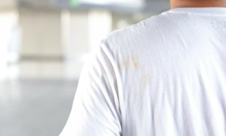 What Causes Yellow Stains on Clothes?