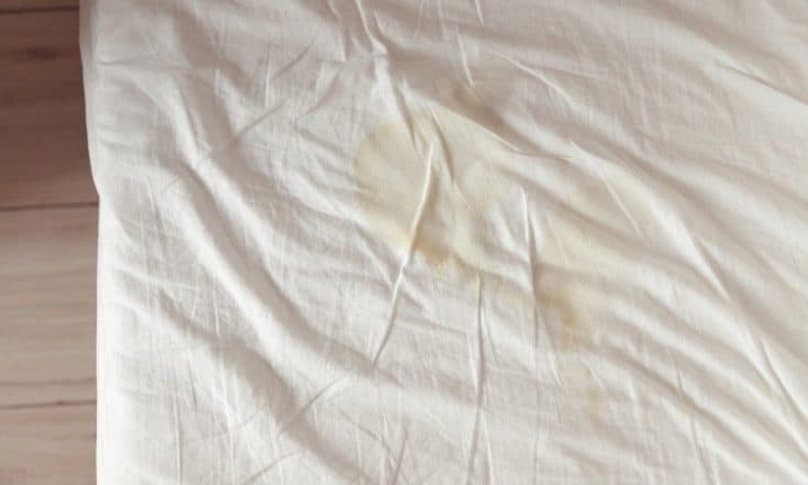How to Remove Yellow Stains From White Cotton Sheets